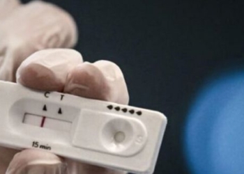 Τι έδειξαν σήμερα τα rapid tests στη Λιβαδειά